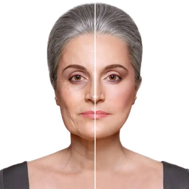 Skin Treatment